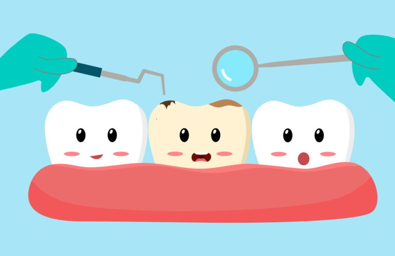 dente nero macchie nere sui denti necrosi Studio Dentistico Yacoub dentista balduina roma implantologia conservativa denti amelia terni