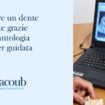 implantologia computer guidata impianto dentale visita dentistica di controllo studio dentistico yacoub dentista balduina roma nord prati cure dentali Amelia terni